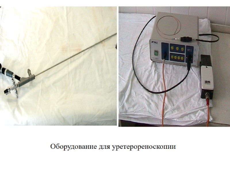 Оборудование для уретерореноскопии